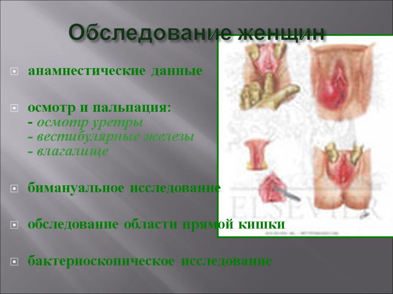 Обследование женщин анамнестические данные   осмотр и пальпация: - осмотр уретры  -